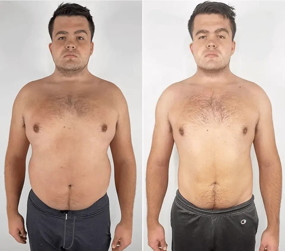 Michael Chumikhin transformation